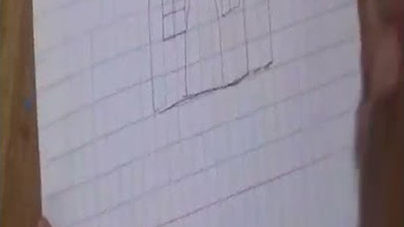 种植牙保修期多久才算合理？**